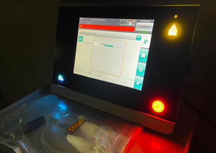 画像:レーザー治療機器