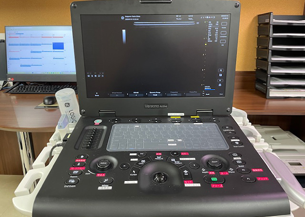 画像:超音波検査機器